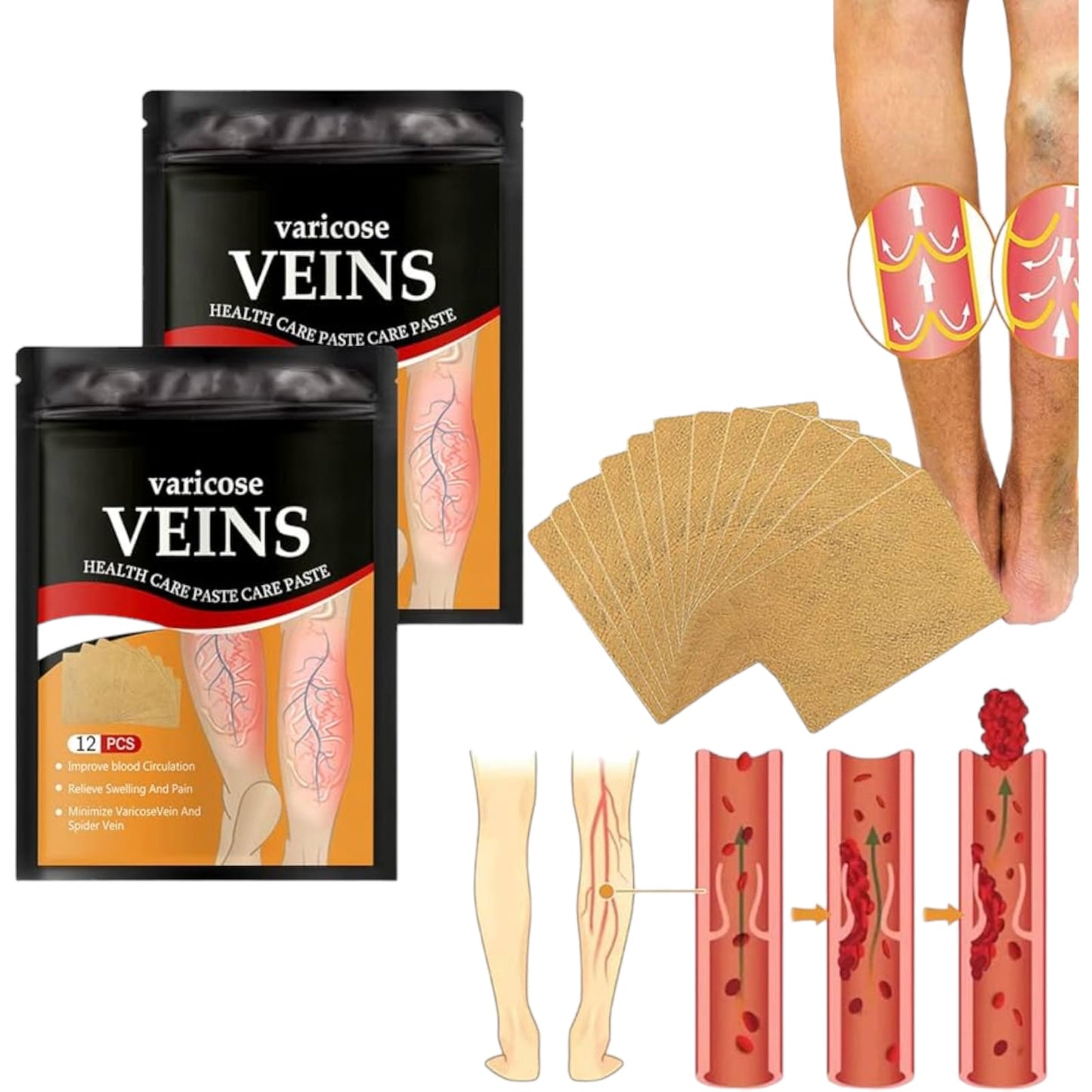 Parche De Pierna Para Tratamiento De Venas Varicosas 12