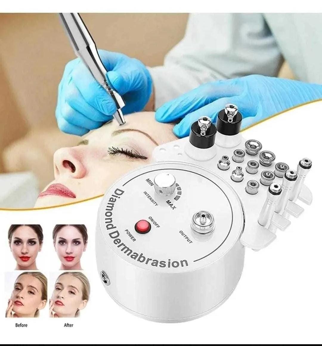 Microdermoabrasión Rejuvenecimiento Facial Peeling Diamond